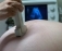 Analize prenatale: ecografia